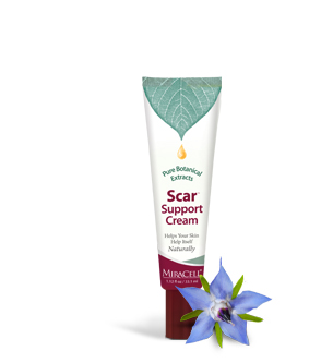 scar support cream bottle next to blue flower